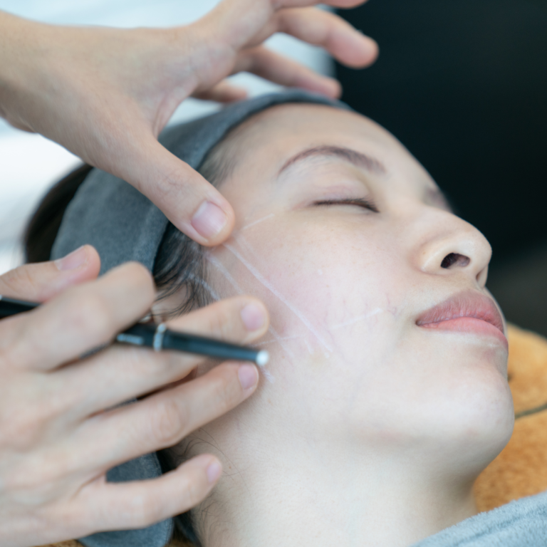 Wrinkle treatment