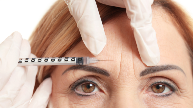 Botox treatment
