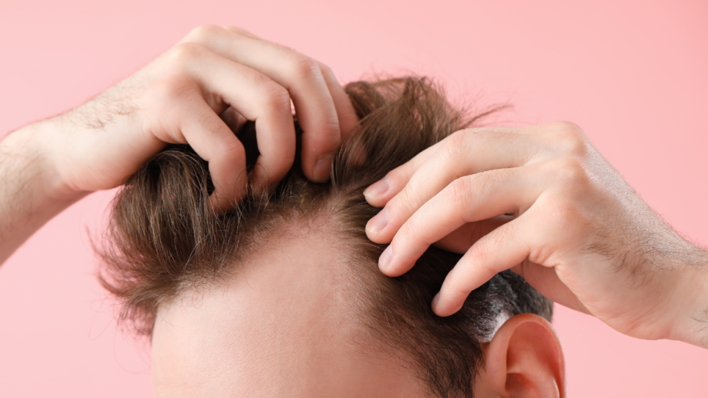 Hair transplantation